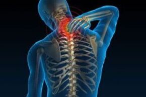 Is é an toradh a bhíonn ar osteochondrosis ceirbheacs ná tinneas sa mhuineál