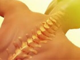 Osteochondrosis - Galar Spine