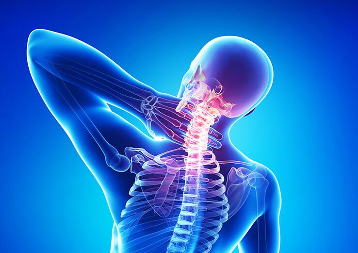 Is galar é osteochondrosis spinal a théann i bhfeidhm ar cartilage articular agus veirteabraí.